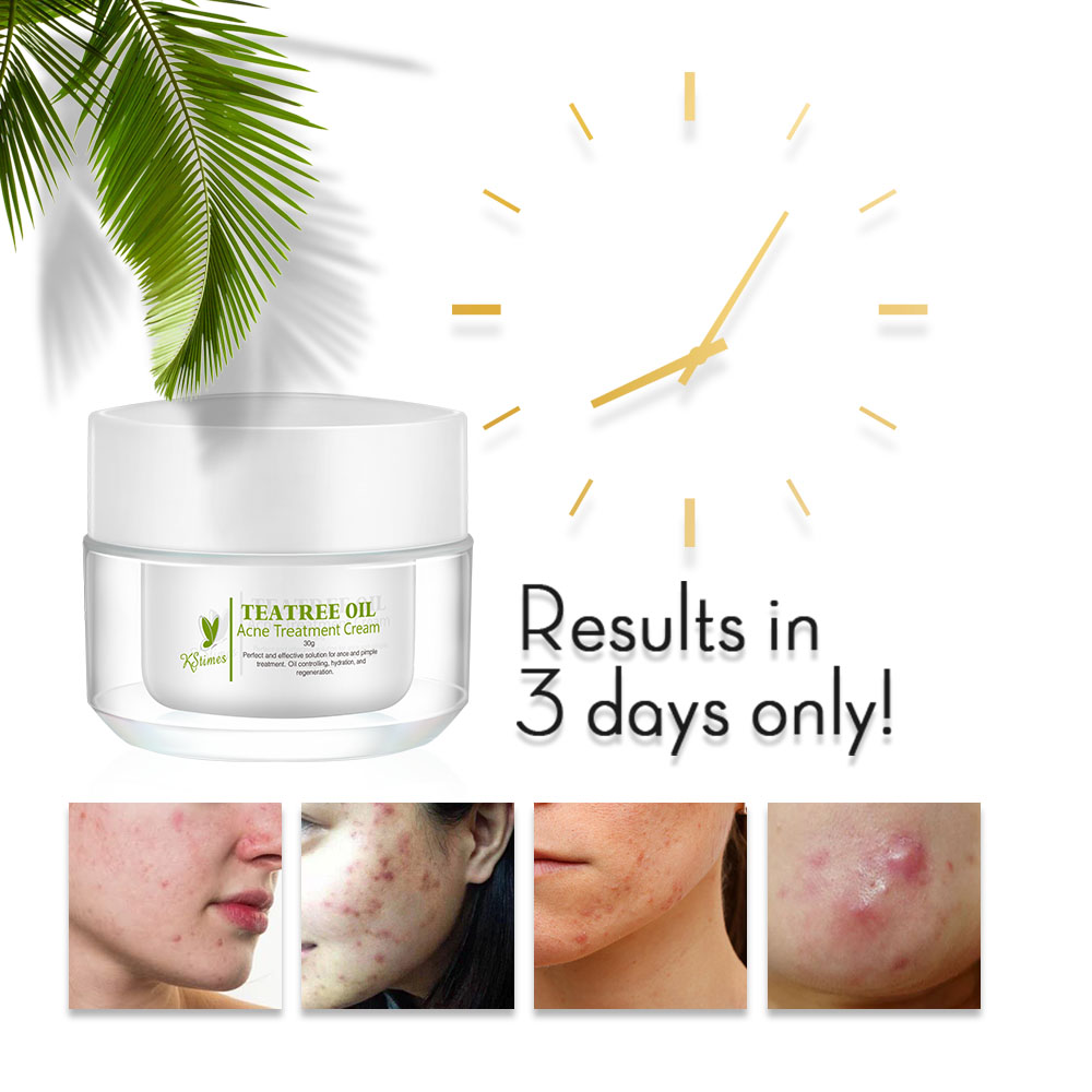 KStims натуральное средство дл – обзор и цена Tea Tree Spot Treatment